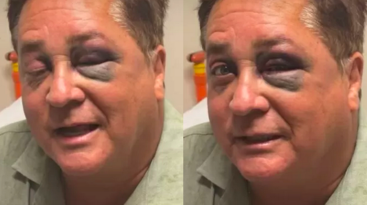Caí com a cara no chão, tava mamado!”: Leonardo diverte ao relembrar queda e olho
